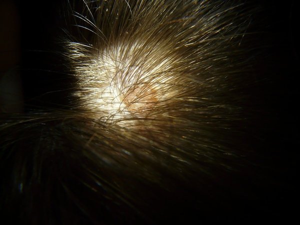 Les avantages des compléments capillaires pour les cheveux et le cuir chevelu